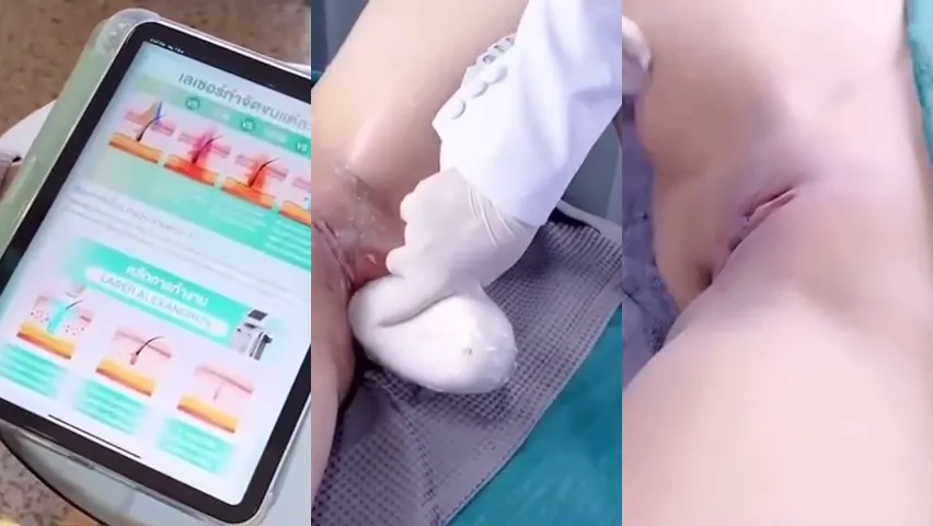 คลิปหลุด รีวิวการเลเซอร์ขนจิมิ ที่เป็นข่าว